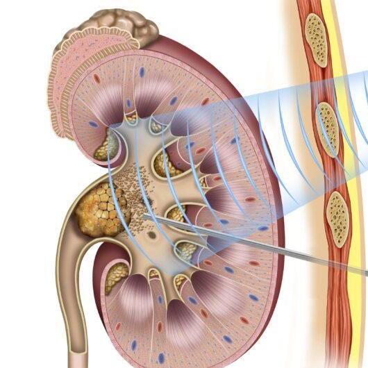 Gauest Gauestarfaana